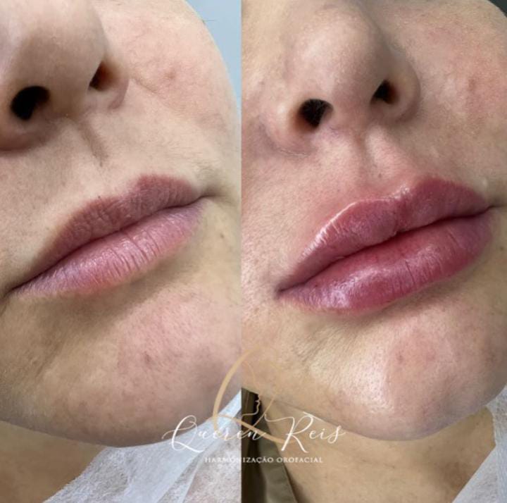 Imagem do WhatsApp de 2023-07-24 à(s) 16.47.061