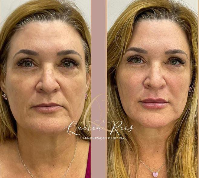 Imagem do WhatsApp de 2023-07-24 à(s) 16.47.072