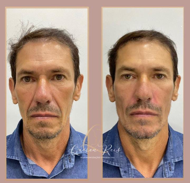 Imagem do WhatsApp de 2023-07-24 à(s) 16.47.073