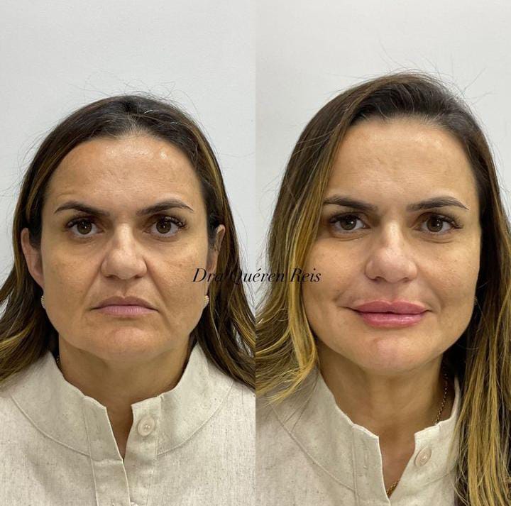 Imagem do WhatsApp de 2023-07-24 à(s) 16.47.074