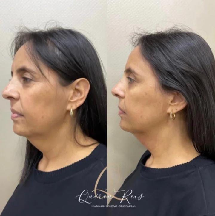 Imagem do WhatsApp de 2023-07-24 à(s) 16.47.075